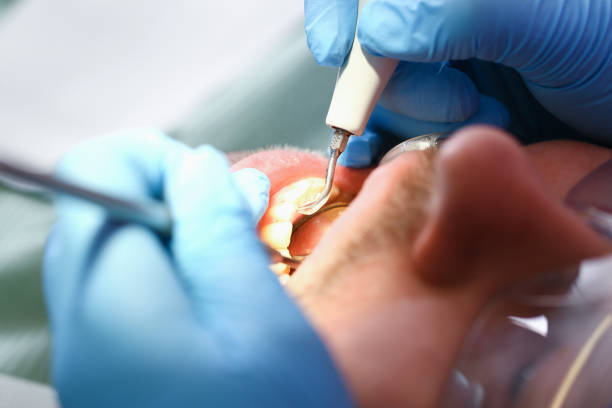 Best Emergency Dentist for Knocked-Out Tooth in Eastvale, CA