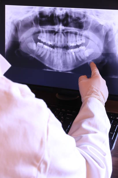 Best Broken or Cracked Tooth Emergency Dentist in Eastvale, CA